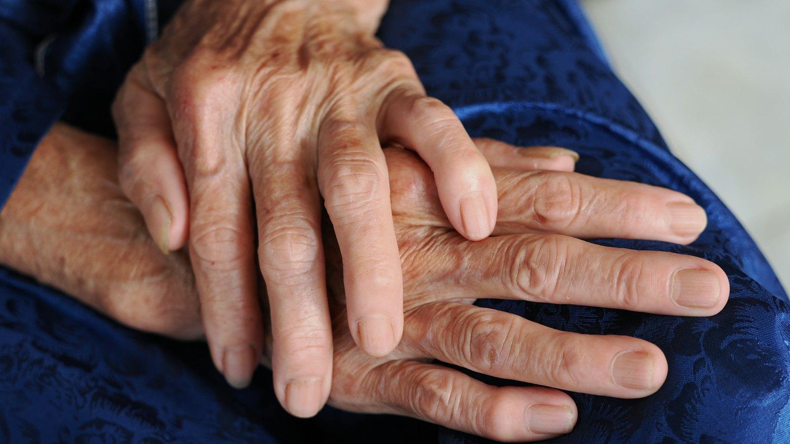 Older person's hands resting together in their lap